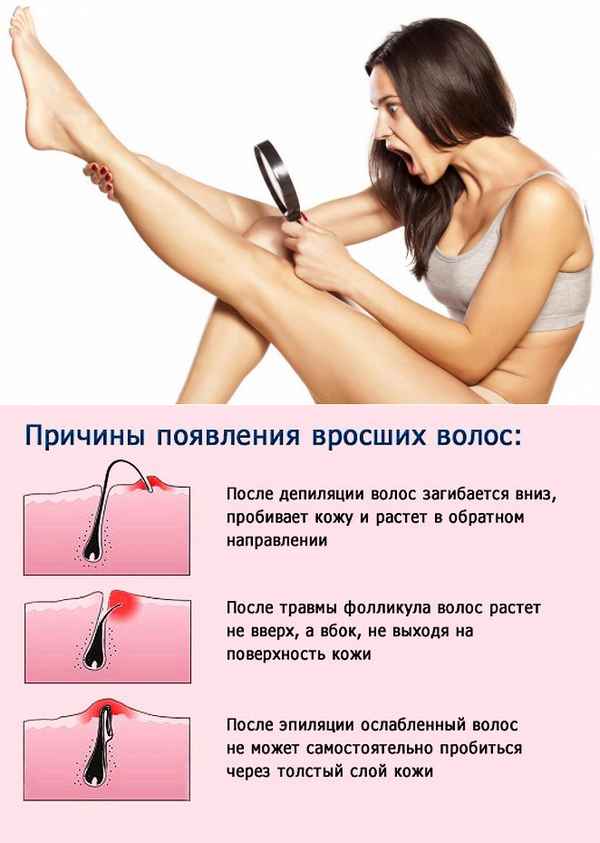 Что делать после эпиляции эпилятором? Уход за кожей