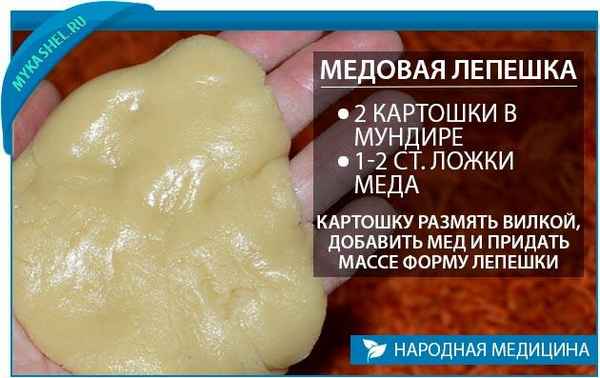 Лепешки от кашля для детей и взрослых при бронхите - рецепт