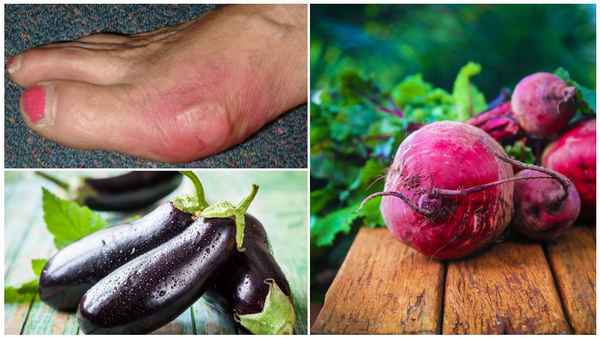 Особенности употрeбления баклажанов при подагре