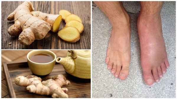 Правда ли, что имбирь помогает от отёков?