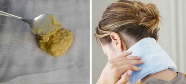 Имбирный компресс для суставов, на позвоночник, шею, гpyдь: сколько держать