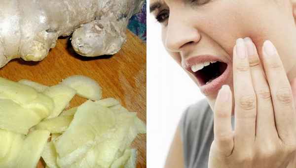 Имбирь для лечения дёсен и зубов