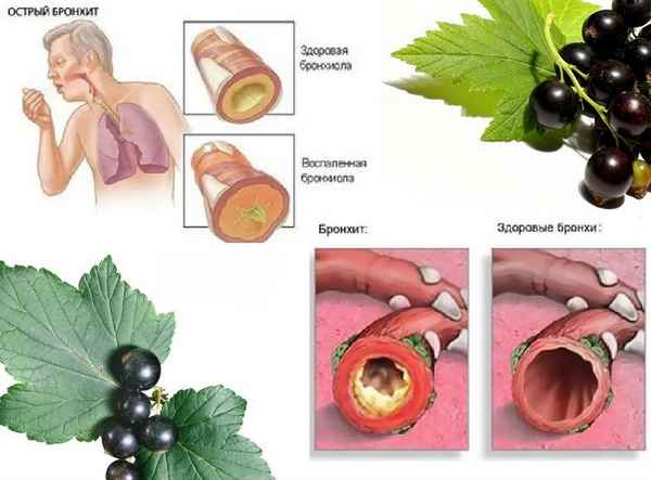 Чёрная смородина при простуде и ОРВИ
