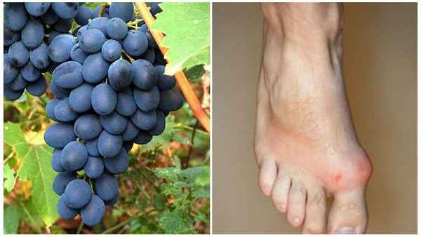 Можно ли употрeбллять виноград при подагре?