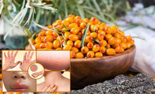 Аллергия на облепиху: бывает ли, симптомы, как избежать